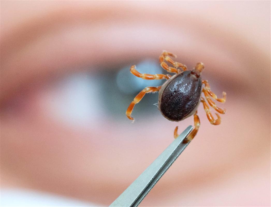 Клещи покусали уже около тысячи жителей Костромской области
