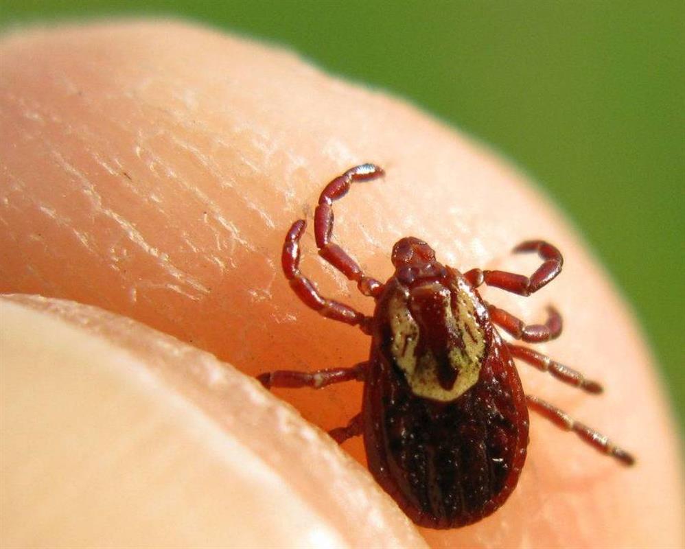 Костромич заболел вирусным энцефалитом после укуса клеща